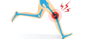 Illustration of runner with knee injury.